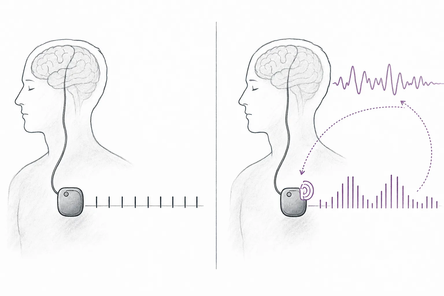Two types of devices compared side by side. One sends pulses of equal height in a straight row; the other has an ear listening to the rhythm of the signal and adjusts the pulse height up and down according to the real symptoms.
